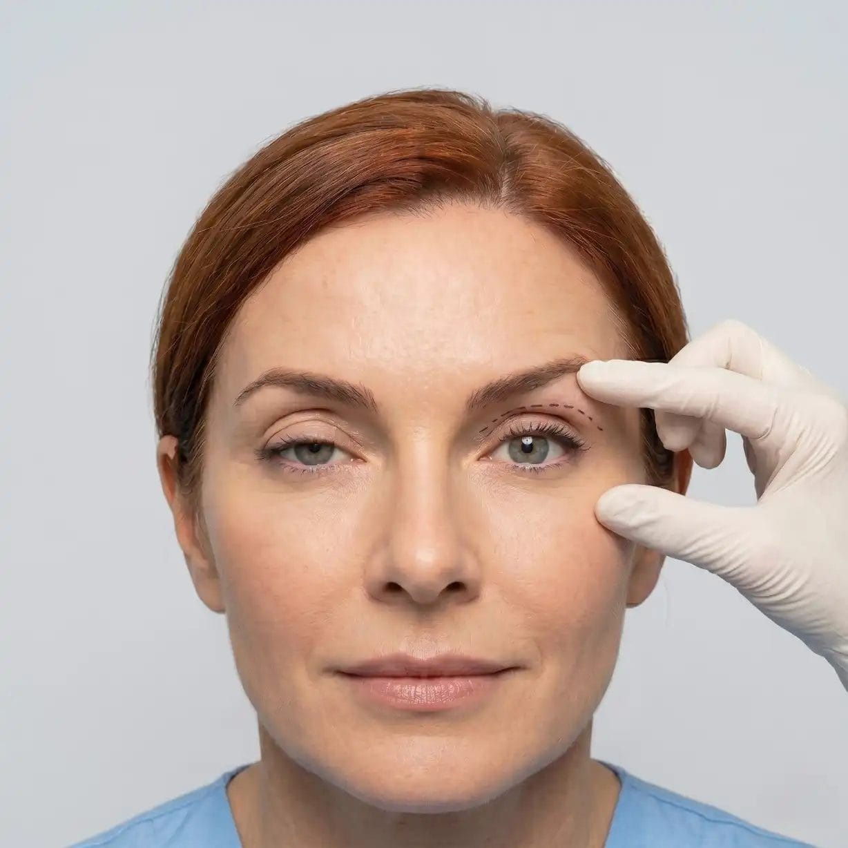 Ptosis repair surgery to correct drooping upper eyelid